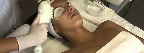 PHOTO-RAJEUNISSEMENT PAR LUMIÈRE PULSÉE